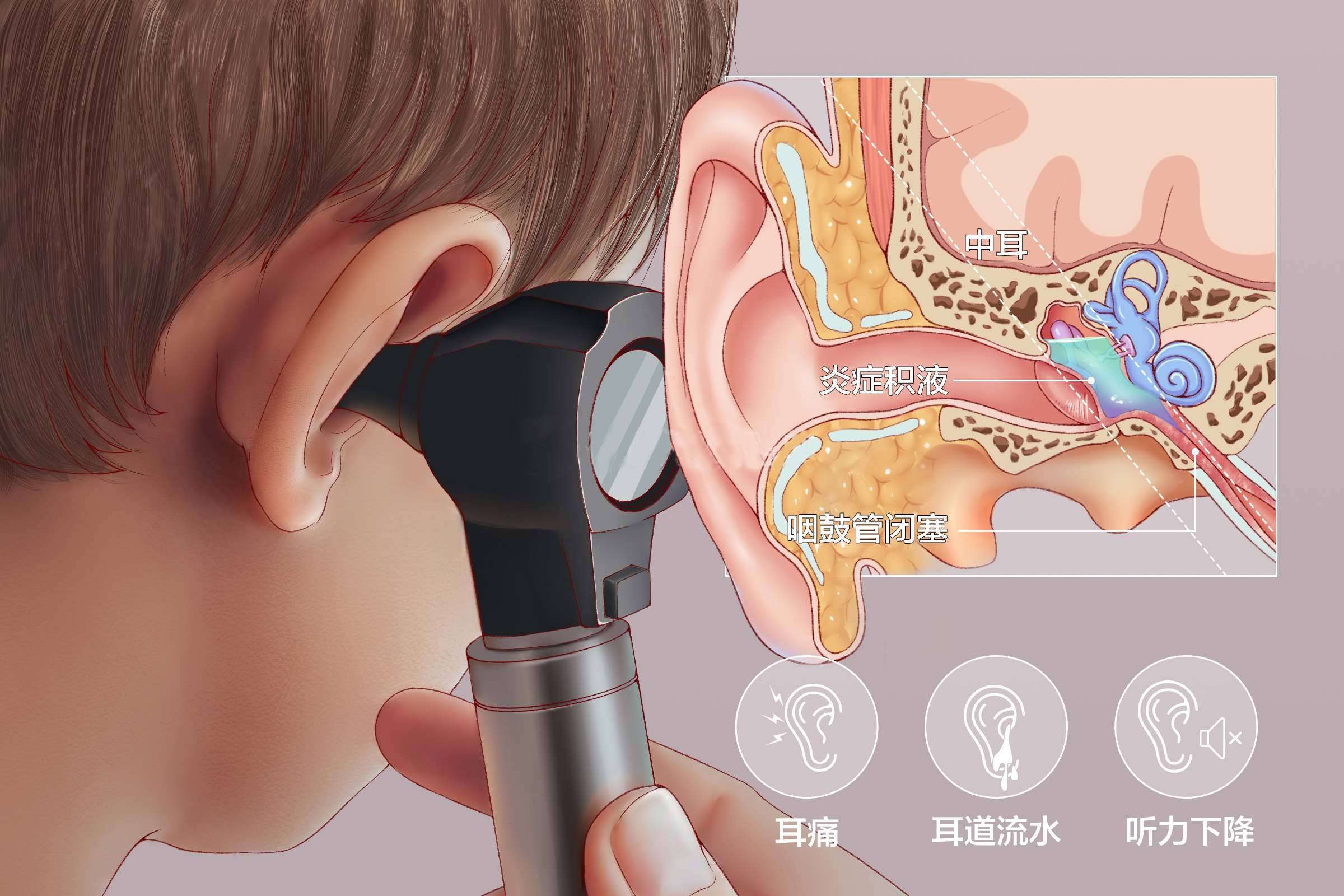 成都中耳炎醫院